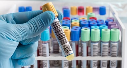 Afbeelding Schaalvergroting strategische oplossing